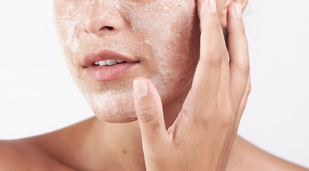 how-to-get-rid-of-blackheads